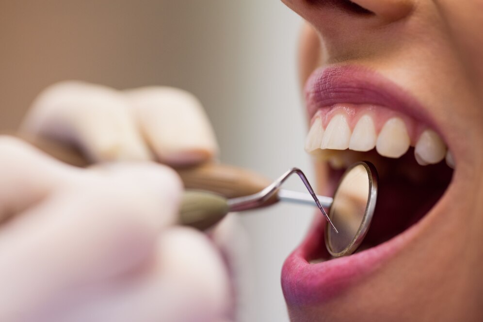 Dental Distress: 5 Clear Signs It’s Time for a Dental Checkup