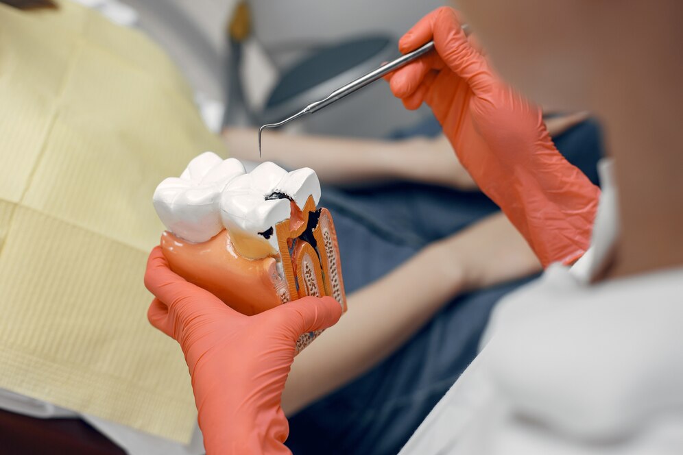 Root Canal Therapy: A Comprehensive Guide to Endodontic Care