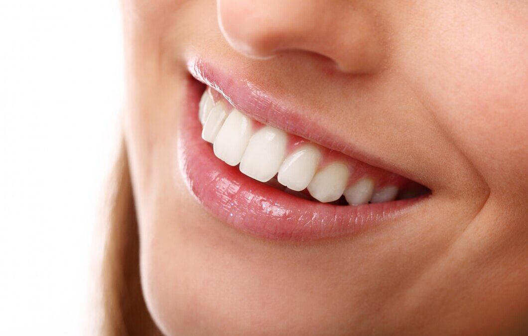 The Hows of Teeth Whitening: And Then What?